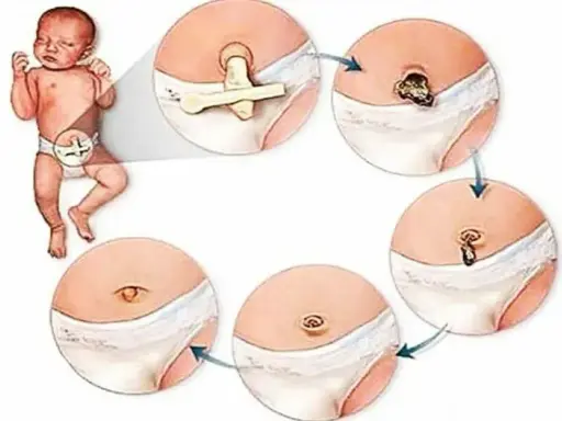 Jak czyścić pępek? Proste zasady higieny i unikania błędów
