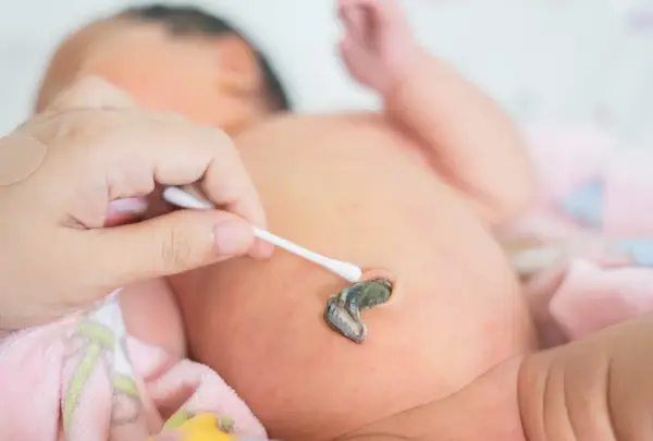 Jak czyścić kikut pępowinowy? Prosty poradnik dla rodziców